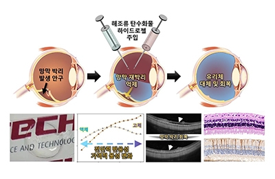 화공/융합 차형준 교수팀, 실명 유발하는 망막 박리, 끈적한 미역으로 치료한다 관련 이미지